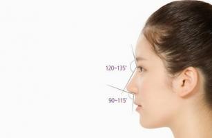 Địa chỉ nâng mũi đẹp và an toàn nhất Hà Nội
