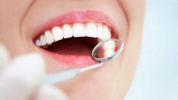 Địa chỉ điều trị viêm nha chu uy tín hàng đầu tại Hà Nội