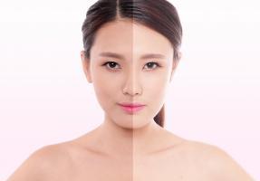 Nước uống trắng da, dưỡng da mềm mịn từ bên trong được yêu thích nhất hiện nay