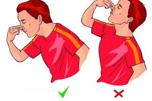 Điều cần biết khi bị chảy máu cam