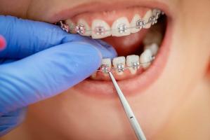 Nha khoa tốt nhất huyện Gia Lâm, Hà Nội