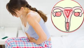 Dấu hiệu của bệnh ung thư cổ tử cung ở phụ nữ