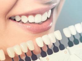 Địa chỉ bọc răng sứ thẩm mỹ tốt nhất tại quận Thanh Xuân, Hà Nội