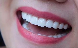 Địa chỉ bọc răng sứ uy tín nhất Nha Trang