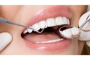 Địa chỉ bọc răng sứ uy tín nhất tỉnh Gia Lai