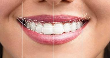 Địa chỉ cắt lợi uy tín nhất Hà Nội