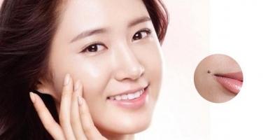 Địa chỉ điều trị tẩy nốt ruồi hiệu quả nhất Hà Nội