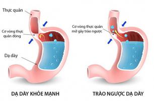 Địa chỉ khám và điều trị bệnh trào ngược dạ dày uy tín nhất Hà Nội