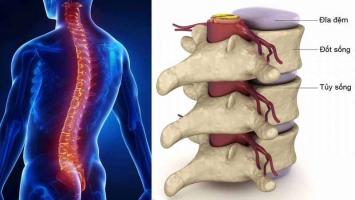 Địa chỉ khám và điều trị thoái hóa cột sống tốt nhất TP. Hồ Chí Minh