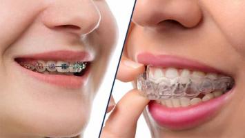 Địa chỉ niềng răng uy tín nhất tỉnh Quảng Bình