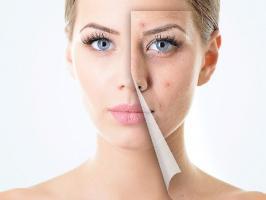 Địa chỉ trị thâm uy tín nhất tỉnh Bình Định