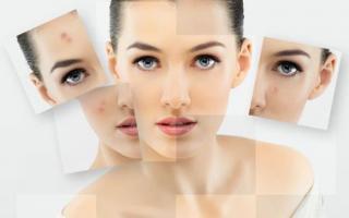 Địa chỉ trị thâm uy tín nhất tỉnh Quảng Ngãi