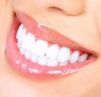 Địa chỉ bọc răng sứ thẩm mỹ tốt nhất tại Quận 10, TP HCM