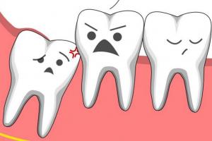 Nha khoa nhổ răng khôn uy tín nhất quận 6, TP. HCM