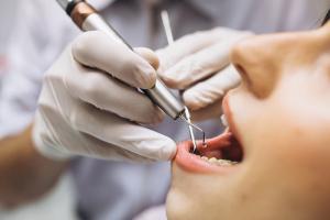 Địa chỉ nhổ răng khôn uy tín, an toàn nhất Hà Tĩnh