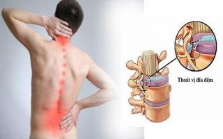 Bệnh viện, phòng khám xương khớp uy tín nhất tại TP. HCM