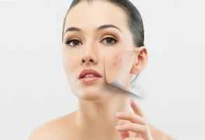 Sản phẩm trị mụn hiệu quả nhất