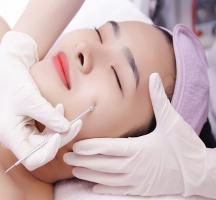 Spa trị mụn hiệu quả nhất quận 7, TP. HCM