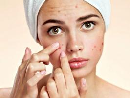 Spa trị mụn hiệu quả nhất Thái Nguyên