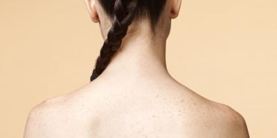Spa trị mụn lưng tốt nhất tại TP Hồ Chí Minh