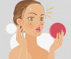 Thói quen xấu gây mụn cám trên da mặt