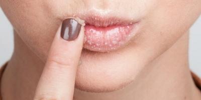 Loại son tẩy da chết cho đôi môi mềm mại quyến rũ