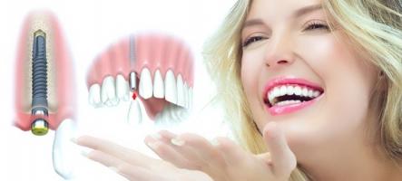 Trung tâm răng hàm mặt uy tín nhất tại Đà Nẵng