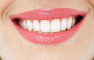 Địa chỉ tẩy trắng răng uy tín hàng đầu tại Hà Nội